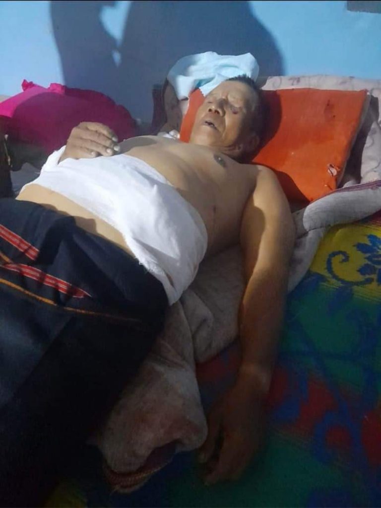 လက်နက်ကြီးထိမှန်၍ မိုးဗြဲတွင် အဘိုးတစ်ဦးသေဆုံး