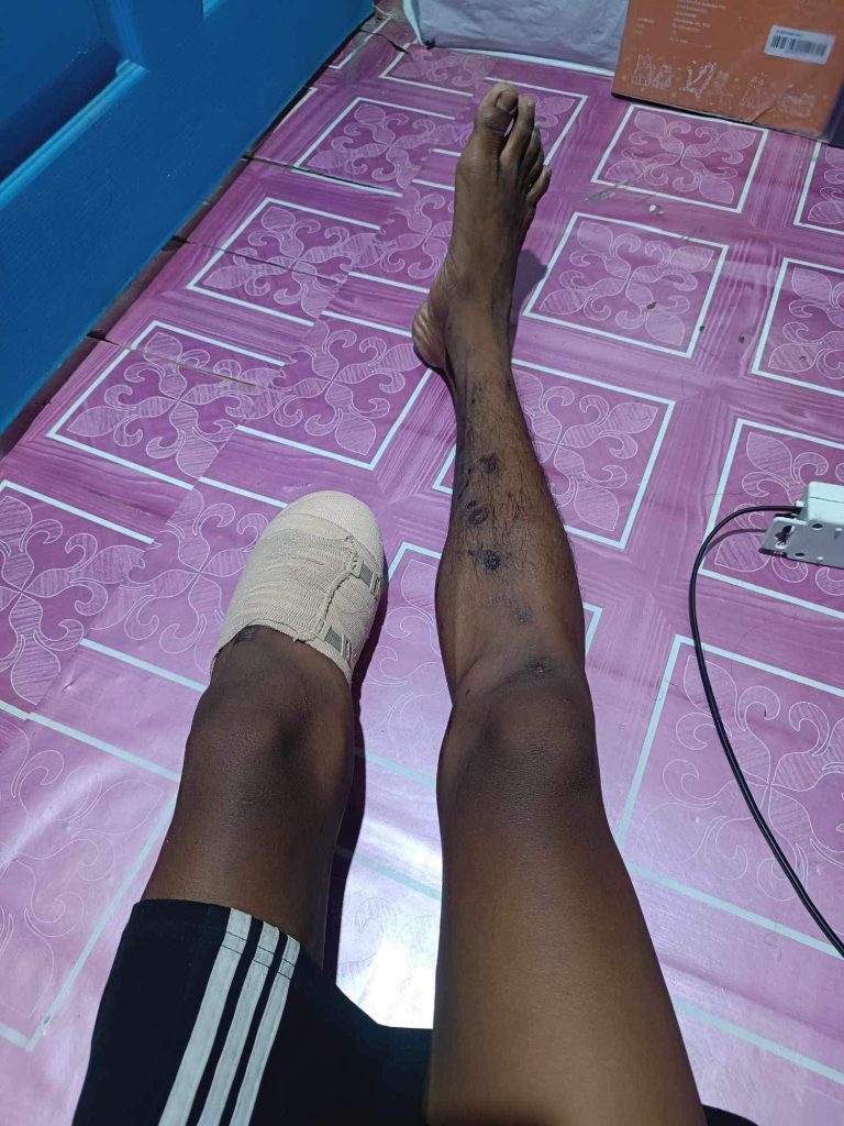 မြန်မာနိုင်ငံ၌ မိုင်းအသိပညာပေးလုပ်ငန်းများ ထပ်တိုးလုပ်ဆောင်ရန်လိုအပ်