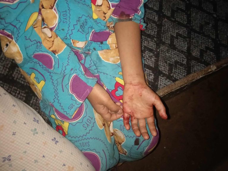 မိုးကုတ်ကို စစ်ကောင်စီ ဗုံးကြဲတိုက်ခိုက်မှု ကလေးငယ်များအပါ ထိခိုက်သူများရှိ