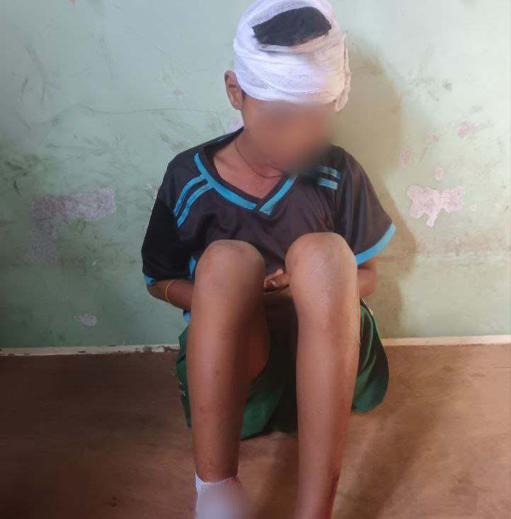 ဂွတွင် စစ်ကျန် ဗုံးသီးပေါက်ကွဲ၍ ကလေးငယ်တစ်ဦးသေဆုံး၊ နှစ်ဦးပြင်းထန်ဒဏ်ရာရ